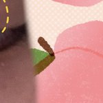 쌍수 붓기ㅠㅠㅠㅠ