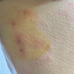 [방탈죄송] <b>펫</b><b>샵</b>주인이 키우는 강아지에게 물렸습니다..