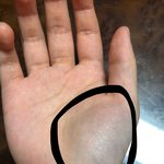 [드루와] 얘들아 나 이렇게 부어올랐능데 뭐야...? ㅠㅠㅠㅠ