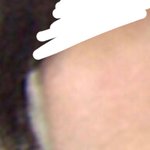 [댓글부탁해] <b>볼살</b> 못뺌?