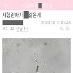 [꼭조언부탁] 제발 시험관까지 하면서 꾸역꾸역 낳지마세요. 애가...