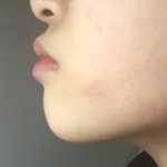 얘들아 나 진짜 주걱턱 <b>개심</b>한데