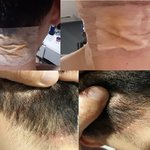 [이것좀봐줘] [혐주의] 염색펌할 때 다들 조심하세요. (1년 고생후기)