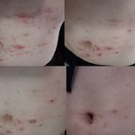 [이것좀봐줘] [혐주의] 염색펌할 때 다들 조심하세요. (1년 고생후기)