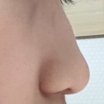 코 땜에 죽고 싶다