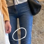 특정<b>부위</b>살찌는법잇니..?