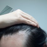 나같은 M자 <b>이마</b> 있니