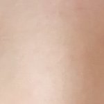 [드루와] (사진있음)나 쌍수 2년차인데