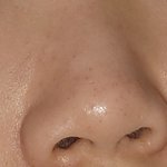 [댓글부탁해] 얘들아 ㅠㅠ 블랙헤드 어케 관리하니...+<b>인중</b>털..