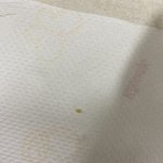 약혐) 애들아 나 <b>편도</b>결석 뺌