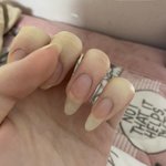 나 <b>손톱</b> 부러진거 개오바임 ㅅㅂ