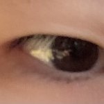 [이것좀봐줘] 얘들아 나 쌍수 하면 성공할까? ㅠㅠ 도와줘