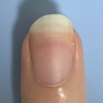 [드루와] 헐 나 <b>손톱</b>살 돌아오고 있다