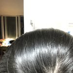 애들아 나 <b>탈모</b>같아..?