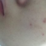 <b>피부</b>원래 <b>개</b>좋았었는데 갑자기 ㅆ창나기 시작했어