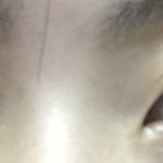 [댓글부탁해] <b>눈</b> <b>성형</b> <b>추천</b>