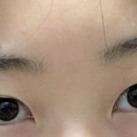 나도 쌍수 할말?