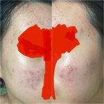 <b>로아</b>큐탄 10일차 후기!!! 사진 혐주의