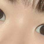 [조언부탁해] 나 <b>짝눈</b>인데 한쪽만 쌍수해야 되나..?