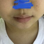 나 졸사 찍는데 너무 <b>볼살</b>이 많아 어떡해 ㅜㅜㅜ