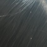 [댓글부탁해] 니네 친구 <b>비듬</b> 보면 얼마만에 잊혀지냐