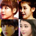 얘들아 턱 이거 뭔 <b>시술</b> 한거임