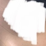 얘들아 나 이거 <b>코</b>수술감임?(<b>사진</b>ㅇ)