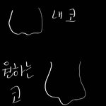 [댓글부탁해] 혹시 콧볼 이렇게 바뀔 수 있는 수술도 있어???