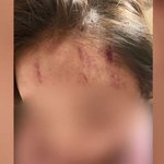 여자친구 마구 <b>폭행</b>해 기절…"두렵다" 했는데 경찰은