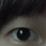 얘들아 나 쌍수해도 눈 ㅈ망이냐