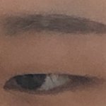 [댓글부탁해] 중 1때 쌍수해 본 사람ㅠㅠ