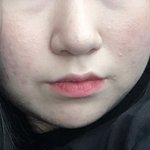 나 피부 <b>한참</b> 심했을떼 화장한거 ㅋㅋㅋㅋ
