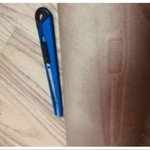 너내가 맞춤법<b>지적</b>해서 나 팔에 칼자국넷어...