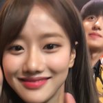 [댓글부탁해] 나 이거 탈모같음???(<b>미방</b>함