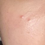 너네도 <b>피부</b> 모공 이 <b>정도</b>로 있음...?