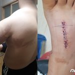 중학교 운동부 코치의 상습폭행…학교측은 '<b>쉬쉬</b>'