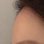 [댓글부탁해] 나 <b>무턱</b> 심해?