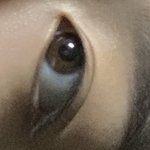 [댓글부탁해] <b>쌍수</b> <b>티</b> 나냐?
