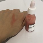 여드름 트러블 자주 나는 애들 이 <b>앰플</b> 써봐