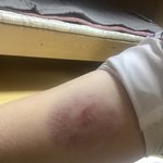 [꼭조언부탁] 친구가 자꾸 장난으로 때리는데 너무 <b>심해</b>
