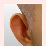 [조언부탁해] <b>귀수술</b> 하고싶은데 엄마한테 뭐라말할까..
