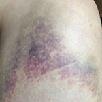 [꼭조언부탁] 자식 가진 부모님들.. 제발 도와주세요. 어머니를...