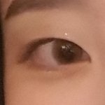 [댓글부탁해] 쌍수 할까말까