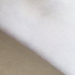 어떻게 <b>한몸</b>에서 색이 이렇게 차이나냐