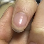 [급해] 얘들아 나 <b>손톱</b> 어떡해??