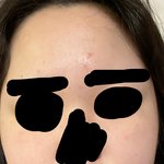 [댓글부탁해] 이 정도 피부로 피부과 가는 거 <b>오바</b>야?