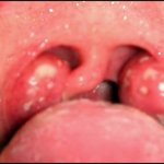 [19] 아가리 <b>똥내</b> x된다..