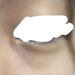 [댓글부탁해] 눈 밑 이거