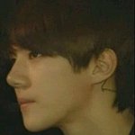 <b>세훈</b> 코 성형