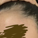 나 헤어라인개<b>미침</b>